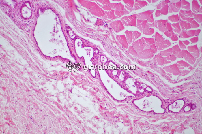 Glande mammaire inactive CT x40 - gryphea.com